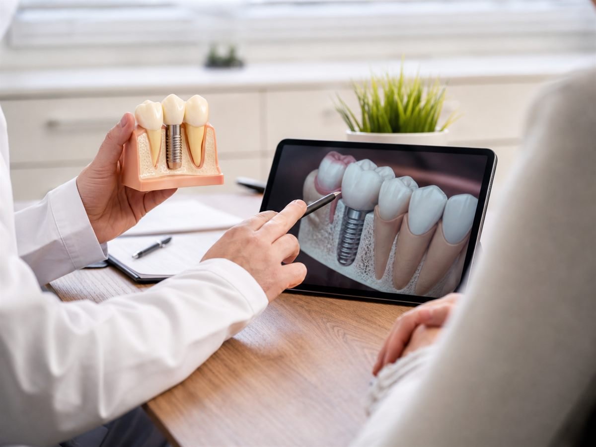 Modelo odontológico e planejamento digital para implante dentário